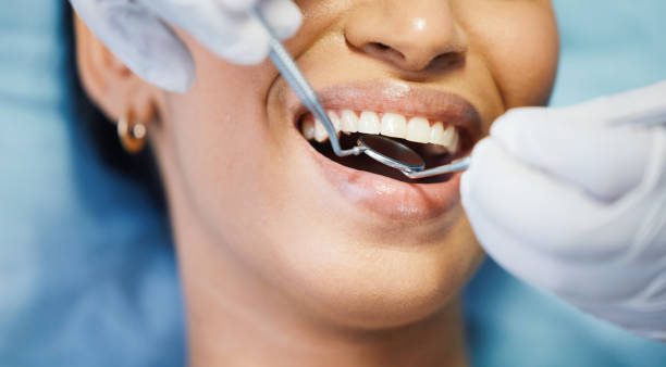 Best Emergency Treatment for Toothache in Seaford, DE